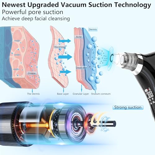 Blackhead Remover Vacuum Face Suction Pore Cleaner with 5 Probes P4135
